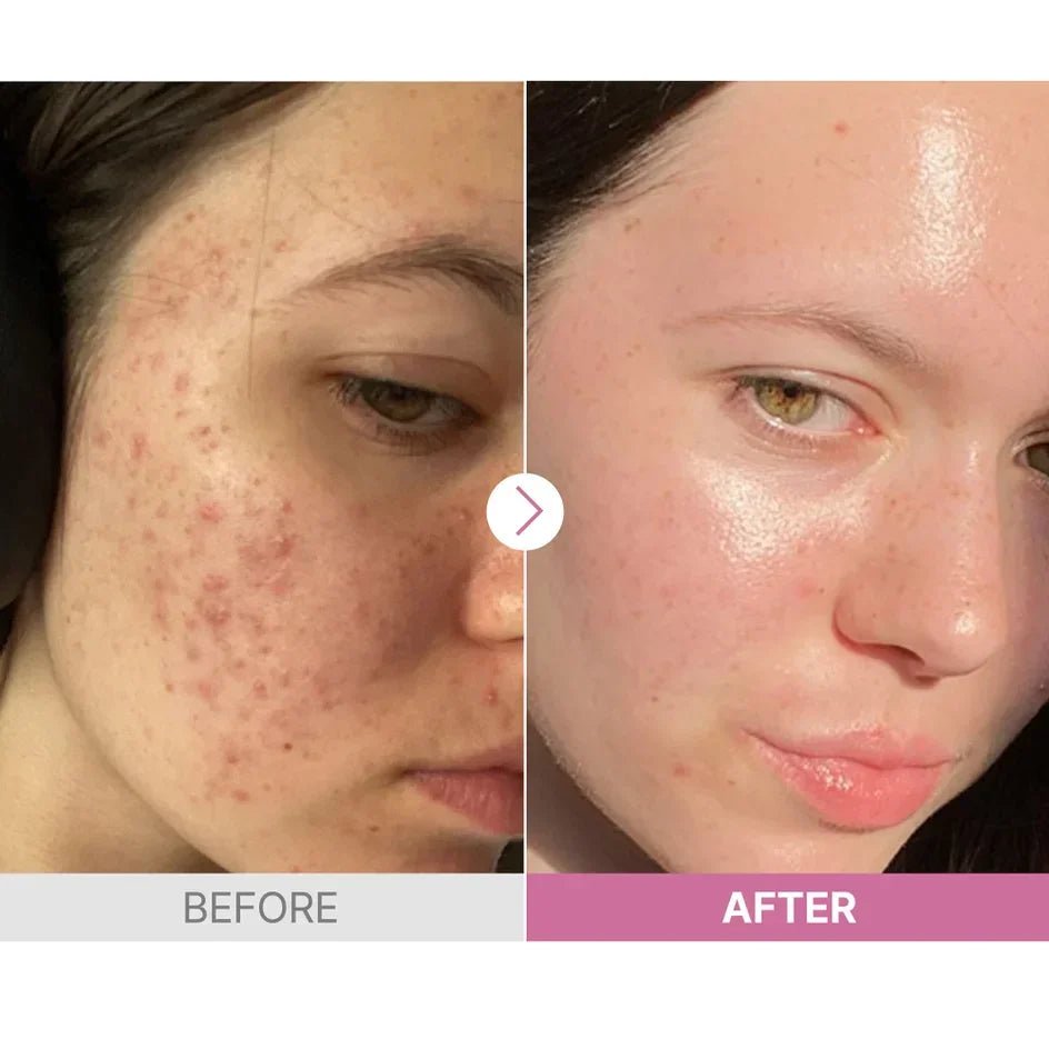 COSRX The Niacinamide 15 Serum. سيروم النياسينامايد 15% من كوزركس - Divine Skin