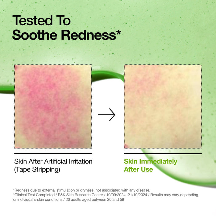 Azelaic Acid 10% Serum + Hyaluron | Redness Relief & Skin Soothing